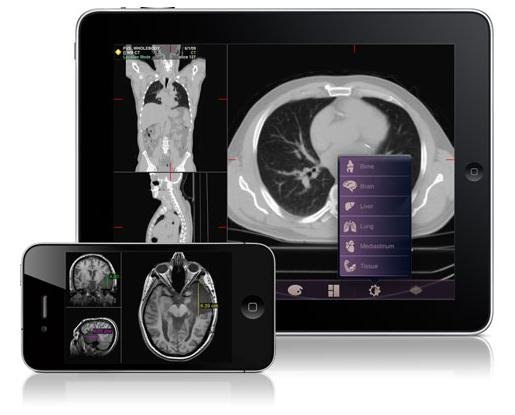 FDAͨ�^(gu��)�ׂ�(g��)�t(y��)���\����(y��ng)�ó���Mobile MIM